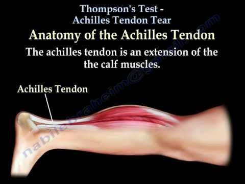 Thompson&rsquo;s Test Achilles Tendon Tear - Everything You Need To Know - Dr. Nabil Ebraheim