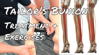 Tailor's Bunion - Treatment & Exercises