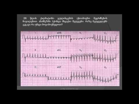 ეკგ / ავ კვანძოვანი რი-ენთრი ტაქიკარდია / ვალსალვის მანევრი, კაროტიდული სინუსის მასაჟი / ვეპაპამილი