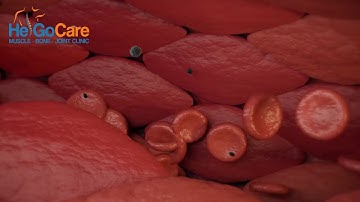 Tác hại bụi siêu mịn đến trẻ em - Bụi siêu mịn PM 2.5