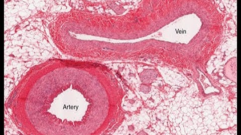 ONLINE Anatomy and Physiology II Lab 4: Cardiovascular System- Blood Vessels