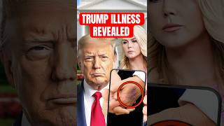 SHOCK Trump Health Announcement…