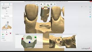 Dental Lab Life: Scanning an Implant in 3Shape