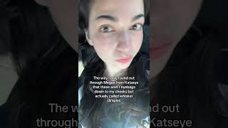 Why am I only finding out about whisker dimples now