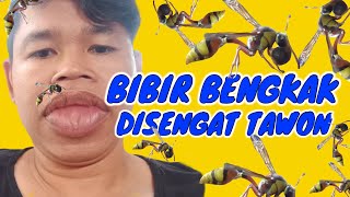 BIBIR BENGKAK DISENGAT TAWON POT