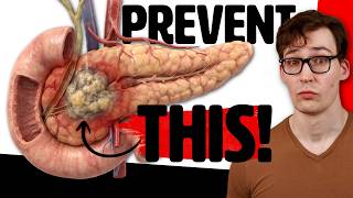 Celebrity Pancreatic Cancer: 750% Increased Risk Wealth