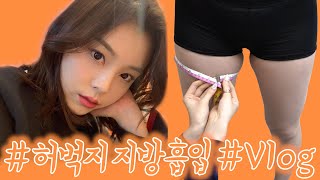 허벅지 지방흡입 Vlog 허벅지 안쪽살 + 승마살 아무리 운동해도 안빠져서 결국 지흡까지!