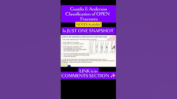 FRACTURES ll Gustilo & Anderson Classification of Open Fractures ✨