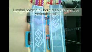 Elektrot yerleştirme
