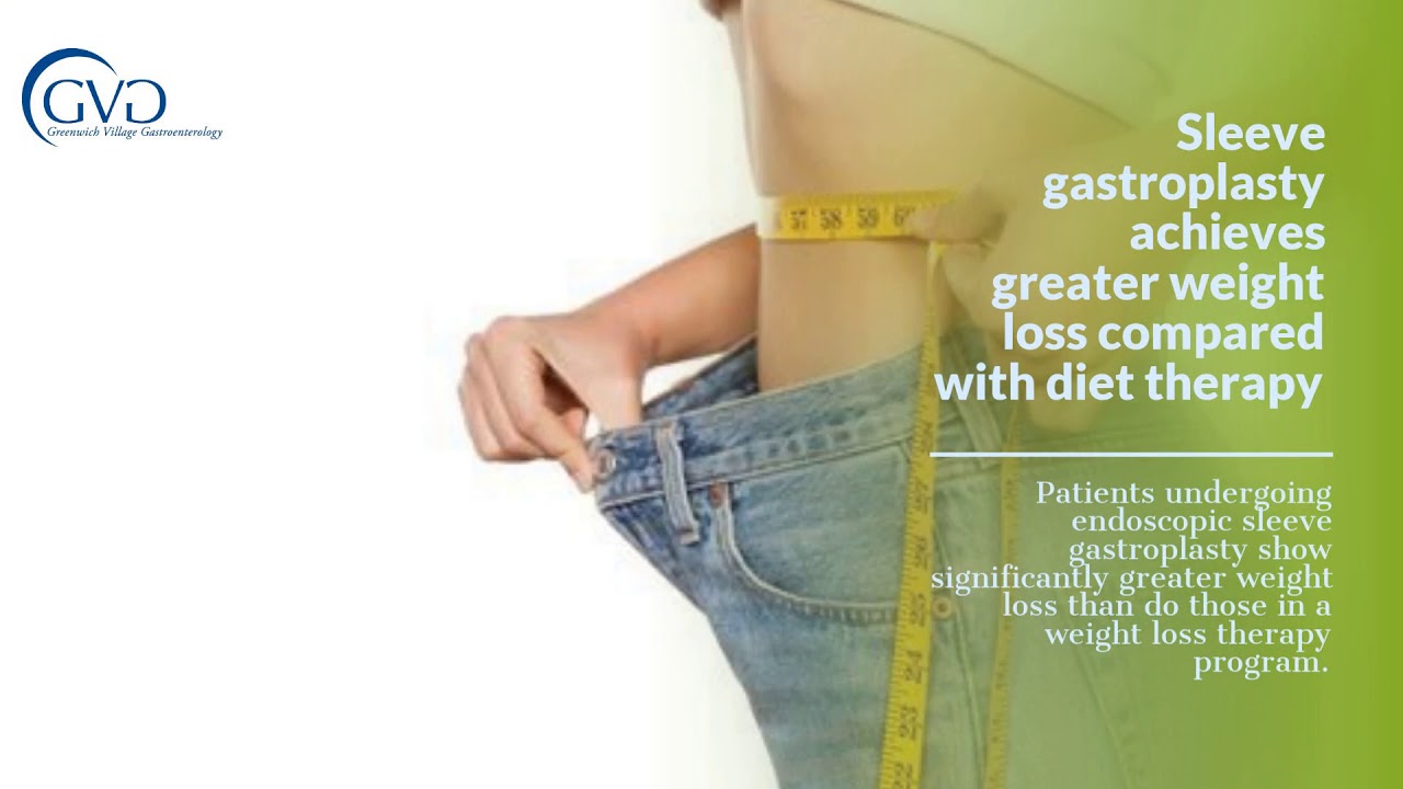 Sleeve gastroplasty achieves greater weight loss compared with diet