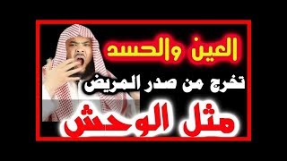 شاهد --- كيف _تخرج العين والحسد _ من جسمك