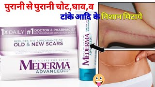 Mederma Scar Gel || कटने के ,घाव,चोट व टांके आदि के निशान मिटाये ||@MedicalJankari