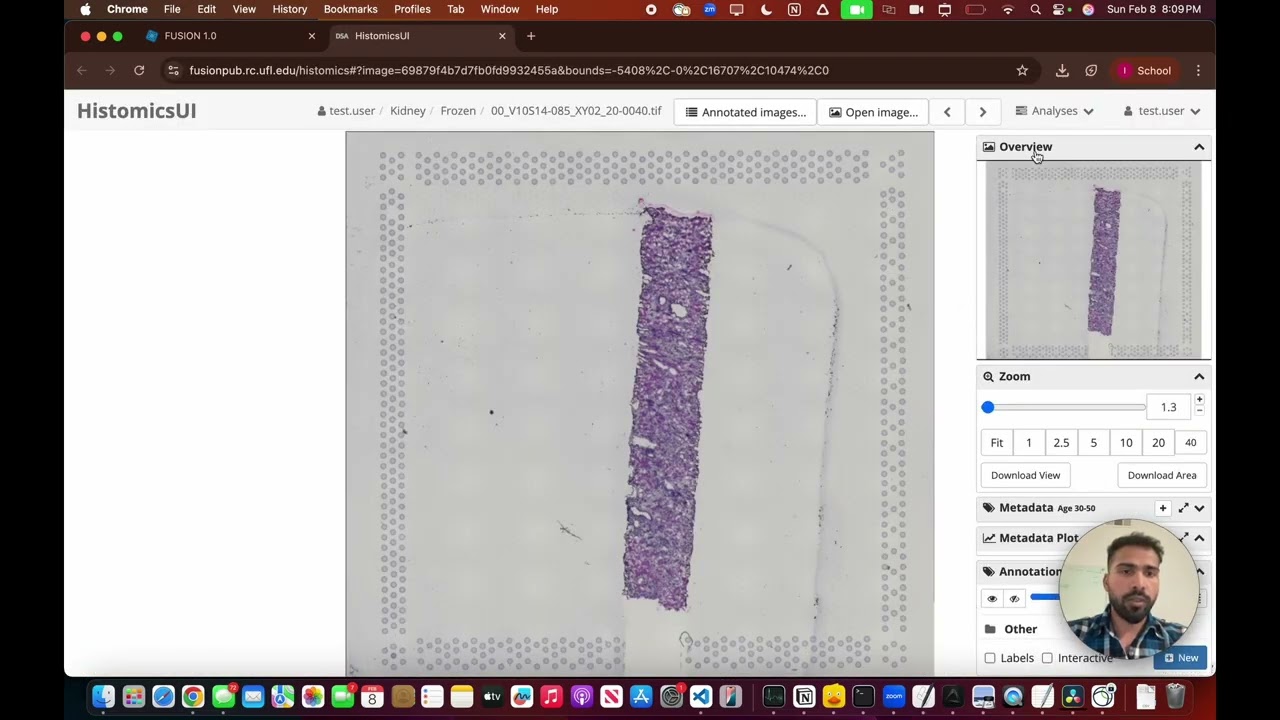 Spot Data Generation from Visium in FUSION 1.0 | Plugin 3 - [Tutorial Video] - Part 6
