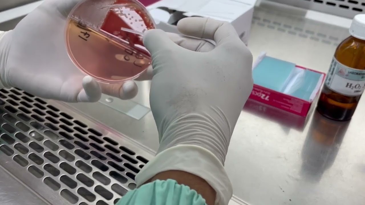 Uji Katalase & Koagulase