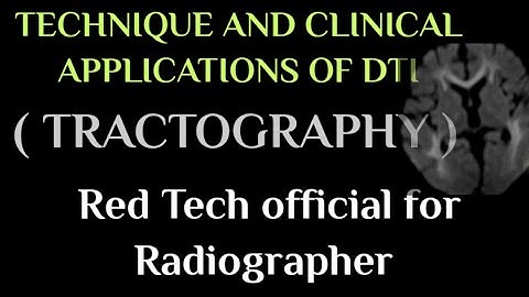 MRI || TECHNIQUE AND CLINICAL APPLICATIONS OF DTI || TRACTOGRAPHY || EXPLAINED IN HINDI ||
