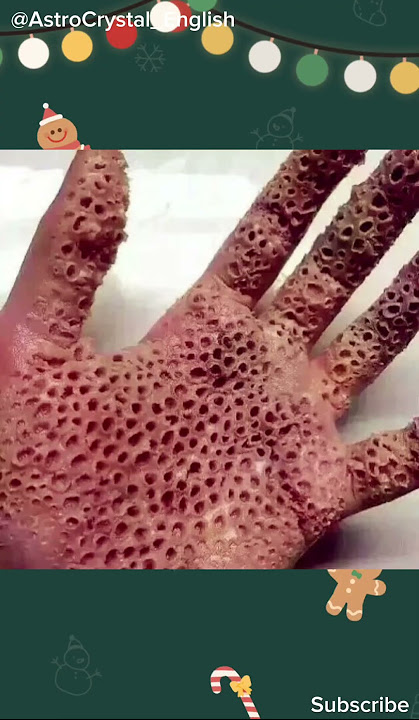 Trypophobia Test