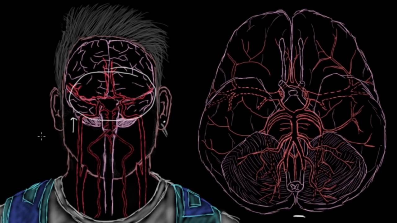 Serebral Kan Akımı (1. Bölüm) (Dolaşım Sistemi Hastalıkları)