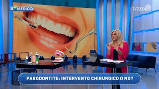 Tutte Le Cure Per La Parodontite