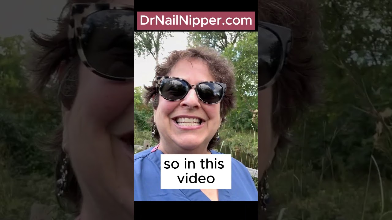 Dr Nail Nipper ➡️ Great Big Ram's Horn Nails on Big Toes 