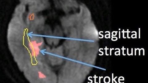 Scientists say they have found the sarcasm center in the brain