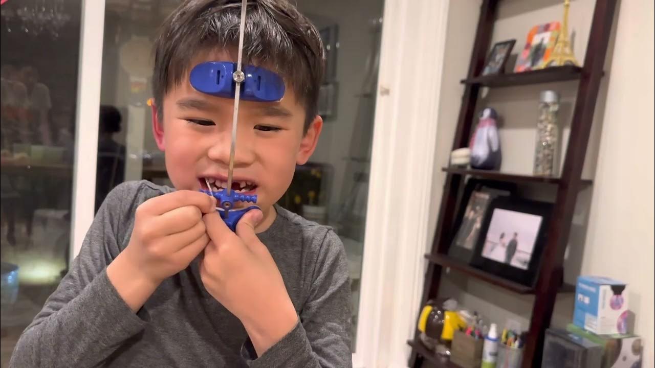 Ryder Underbite Headgear Week 7 How to put on your underbite headgear