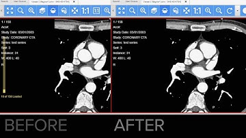 LEADTOOLS HTML5/JavaScript Medical Viewer Speedup in April Update