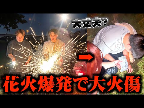 花火してたらりょうくんの花火が爆発して大火傷しましたwwwww