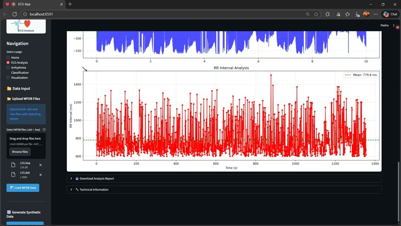 AI-Powered ECG Signal Processing and Arrhythmia Detection System | Artificial Intelligence Systems