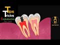 Essential tips and tricks in endodontics  part 1  tips 15