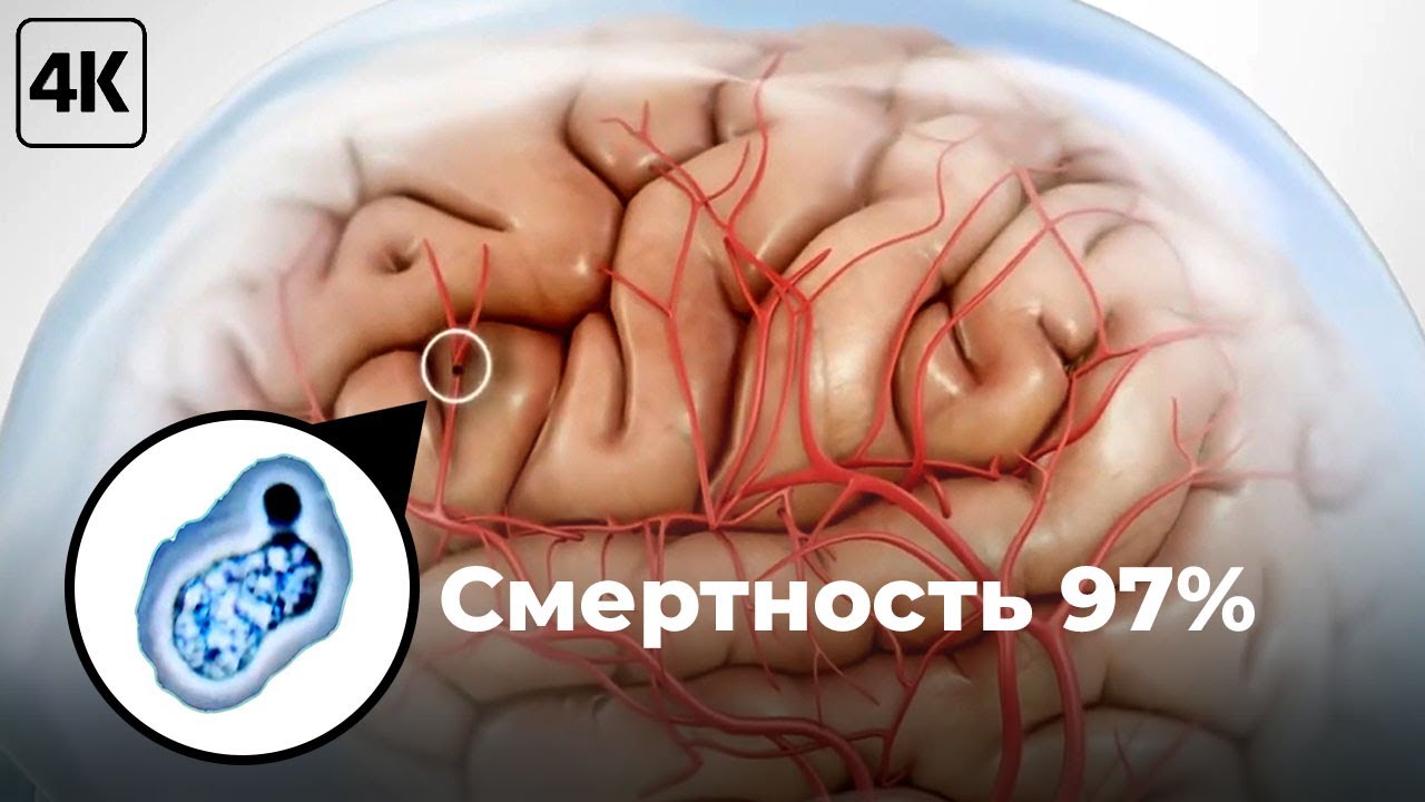 Бактерия, о которой не пишут в новостях. - YouTube