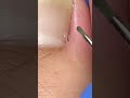 Satisfying nail cleaning process#nailcare #pedicure #satisfying #nailtech #oddlysatisfying #fyp