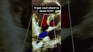 Coloque sua resposta nos comentários!
