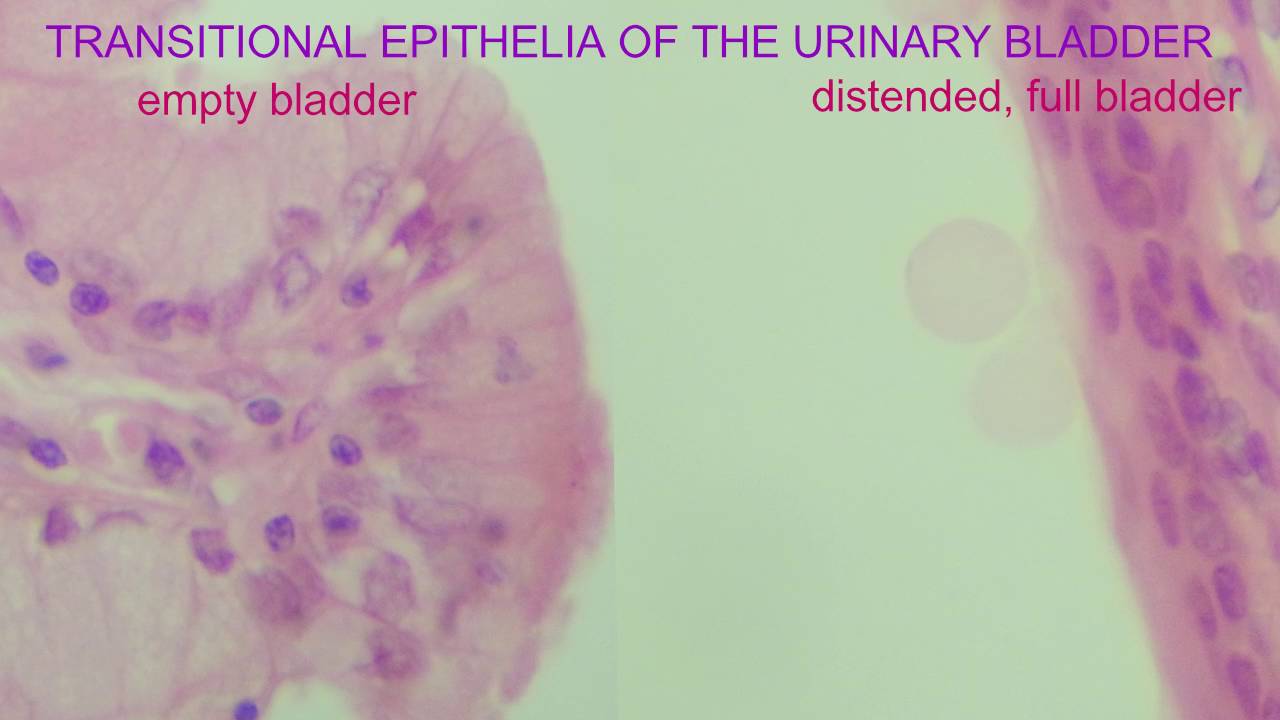 Transitional Epithelia Of The Urinary Bladder Youtube Transitional Epithelia Of The Urinary Bladder Youtube
