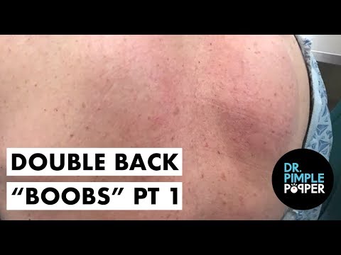 Part 1: He's Not Going to Miss These "Back Boobs"...