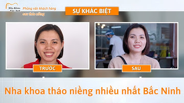 Kiên nhẫn niềng răng 3 năm chị gái lột xác thành một người khác