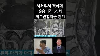 하지방사통으로 못걸으니 서러워서 우는 55세 척추관 협착증 환자 마음이 아프네요 디스크탈출증 비수술적추치료 양방향척추내시경김영우 척추신경외과 김영우 허리통증  #shorts