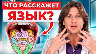 Язык Кричит О Болезнях! / Как Диагностировать Болезни По Языку?