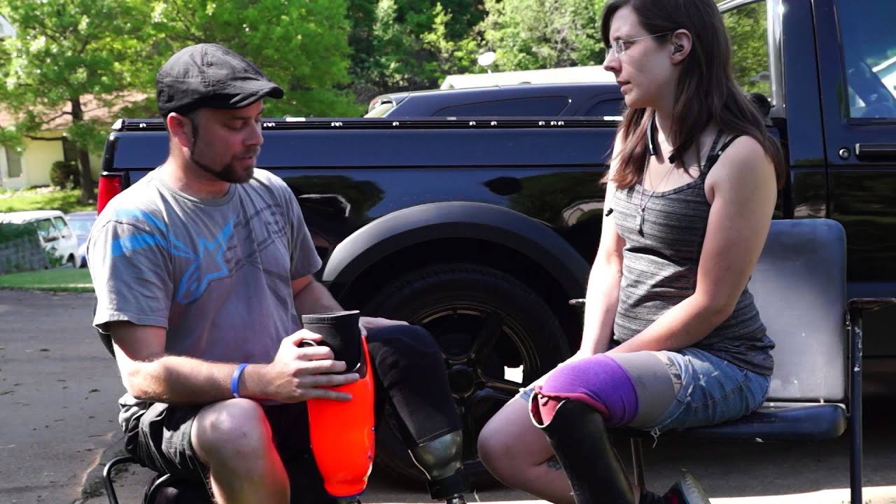 AmputeeOT How an Ohio Willow Wood Elevated Vacuum Limb Logic