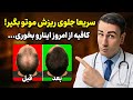موهات داره میریزه سریع این 5 تارو بخور تا دوباره پر مو بشی نسخه خانگی دکتر شبیر برای رویش مجدد مو 