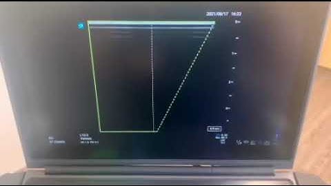 sonosite px tutorial