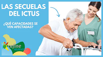 ¿Qué causa la muerte tras un ictus?