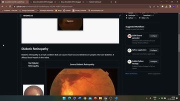 Diabetic Retinopathy Detection Using DenseNet121 model | APTOS 2019 Blindness Detection Dataset