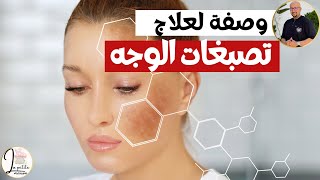 وصفة لعلاج تصبغات الوجه أو البشرة الدكتور عماد ميزاب Docteur Imad Mizab