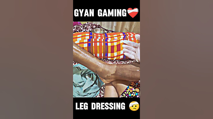 Gyan gaming accident 😱😱 like and subscribe please Gyan Bhai ka liy dhuaa Karo #subscribe