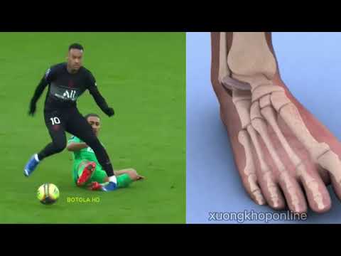 Video Phân tích tình huống lật sơ mi cổ chân của Neymar - youtube