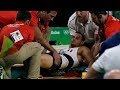 5 World Gymnasts Who Suffered the Worst Injuries