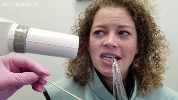 Getting Perfect Horizontal Angulation- Open those contacts