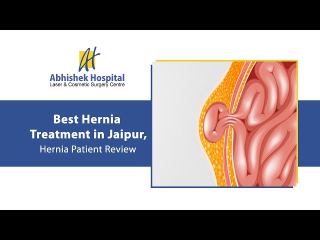 Best Hernia Treatment in Jaipur, Hernia Patient Review