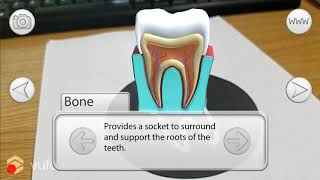 Dentist AR App (Demo) screenshot 5