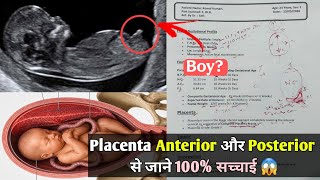 Complete Placenta Previa Ultrasound Report Kaise Padhe | Placenta Anterior or Posterior ka matlab